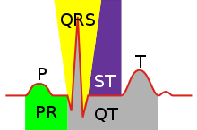 Qt Syndrom Wikipedia