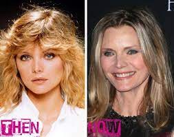 She has had small tweaks, including botox to keep her forehead, glabella (between the brows) and under eye area free of deep wrinkles. Michelle Pfeiffer Archives Page 2 Of 2 Celeb Surgery Com