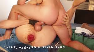 Fisting Prolapse - video 2 - ThisVid.com