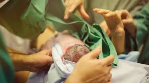 Devamlı aynı yatış pozisyonunda yatırılan bebeklerde ya da bazı dış etkenler dolayısıyla oluşan kafa yamukluğu. Dogumla Ilgili Ilginc Bilgiler Hamilelik