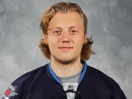 PHOTO: Jets' prospect Ryan Olsen shows off battle scars after rough day