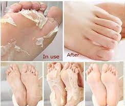 Here Is A Basic Homemade Recipe For Removing Dead And Dry Skin From Feet This Will Peel Off And Remove The Dried Laye Skin So Soft Baby Soft Skin Peeling Skin