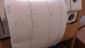 Doppler Ultrasound Investigation Chart Evaluation Pregnant