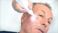 Una nueva era para los procedimientos no invasivos en oftalmología