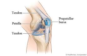 Image result for Prepatellar Bursitis