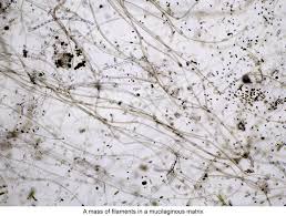 Image result for Microcoelia nyungwensis