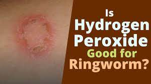 Allow the bleach solution to remain on all surfaces for 10 minutes to kill the spores. Hydrogen Peroxide For Ringworm Can It Kill Ringworm Youtube