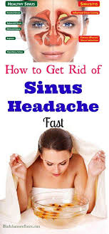7 Home Remedies For Sinus Headache Fast Relief Home Remedies For Sinus Natural Headache Remedies Sinus Headache