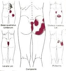 Self Myofascial Release For Chronic Pelvic Floor Pains Ajimshaw S Approach Part Ii Specific Sessions I Ext Pelvic Floor Dysfunction Pelvic Girdle Pelvic Floor