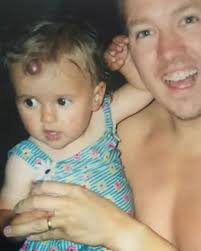 Molly-Mae Hague's dad speaks about 'unfair' and 'prominent' birthmark she  had as a kid