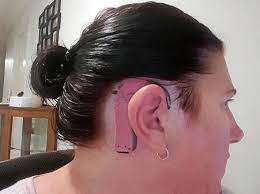 If you are someone that normally tucks their hair behind. Mum Gets Tattoo To Match 9yo Daughter S Cochlear Implant Sunshine Coast Daily