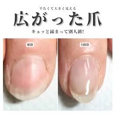 爪 横 に 広がる