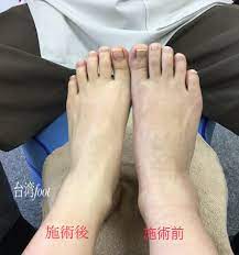 武蔵村山 足つぼ専門 台湾foot