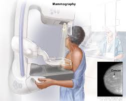 Stage 1 breast cancer is the earliest stage of what's considered invasive breast cancer. Breast Cancer Awareness How To Tell If A Breast Lump Is Normal Or Abnormal Naomi D Souza Writer Food Lifestyle Blogger In Dubai