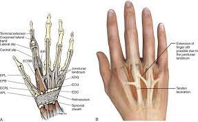 To their anatomic location on the femur. Extensor And Flexor Tendon Injuries In The Hand Wrist And Foot Veterian Key
