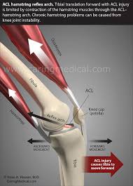 One or more ligaments provide stability to a joint during rest and movement. Chronic Muscle Spasms And Tightness Can Indicate You Have A Ligament Problem Not A Muscle Problem Caring Medical Florida