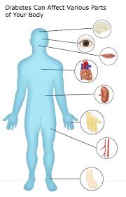 We did not find results for: Complications Diabetes Education Online