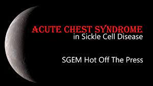 Acute Chest Syndrome Sickle Cell Disease First10em