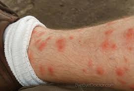 Pin Em Assessment