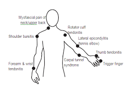 Https Www Ohcow On Ca Edit Files General Handouts Workrelatedmusculoskeletaldisorders Pdf