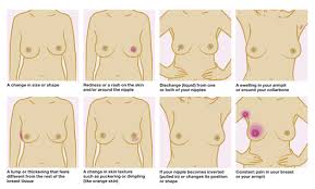 The collarbone is a long bone that connects to the scapula and the breast bone. Five Steps Of A Breast Self Exam South East London Breast Cancer Trust