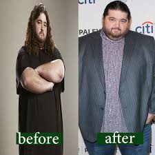 Laura garcia and jorge garcia are organizing this fundraiser. Jorge Garcia Weight Loss 2020 Shocking Secrets You Must Know Fms Weight Loss