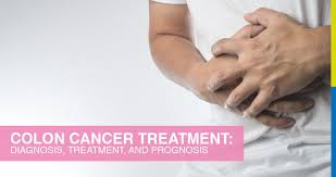 It accounts for up to 15 percent of how do you detect colon cancer? Colon Cancer Treatment Diagnosis Treatment And Prognosis Sincere Healthcare Group