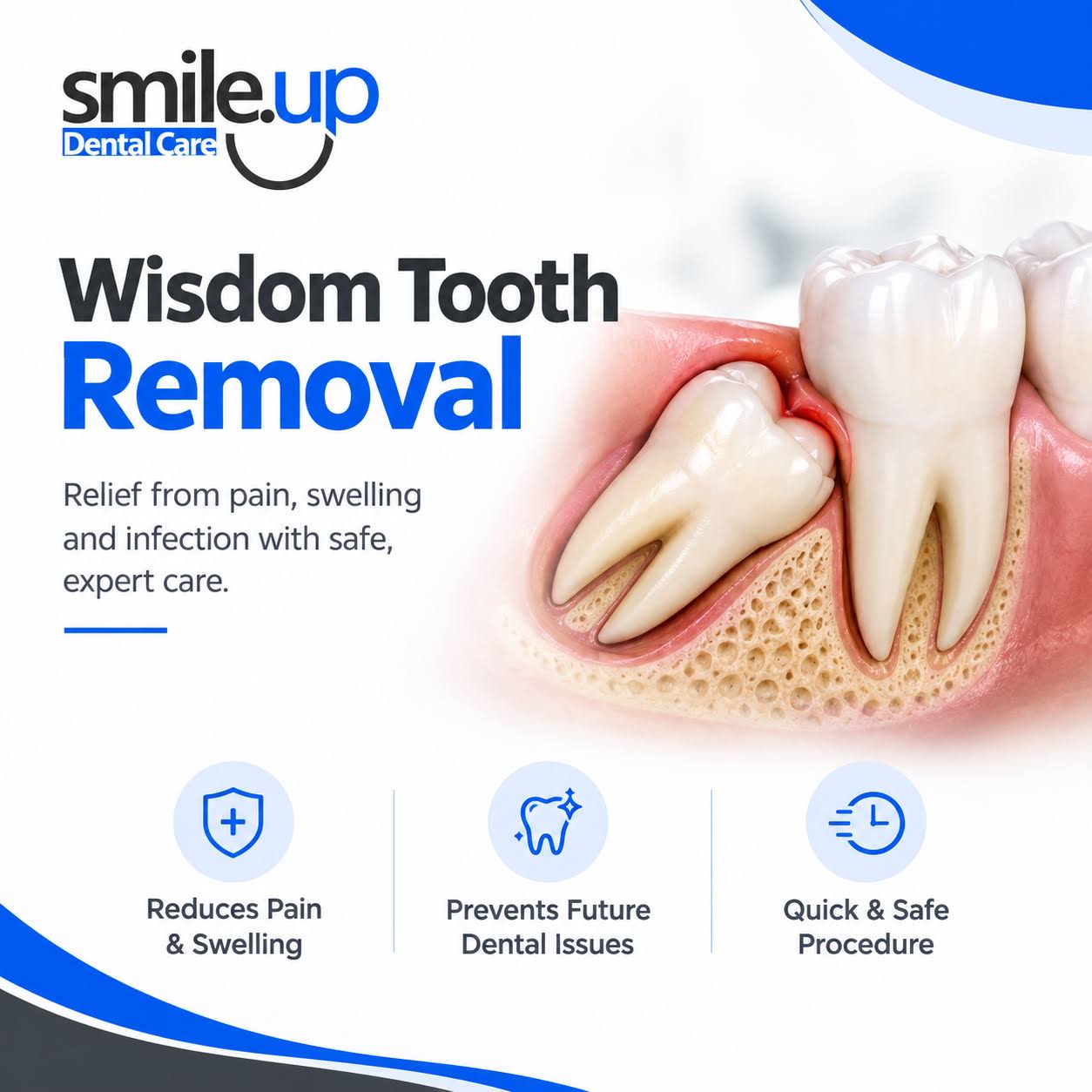 Wisdom Tooth Removal product image