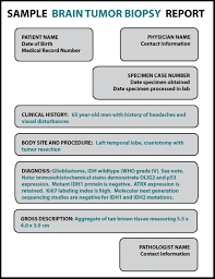 There are many different types of brain tumors. Understanding My Report Brain Tumor Johns Hopkins Pathology