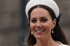 Katemiddleton #Veneer #Veneertok #Veneers #Veneerscheck #Veneercheck... |  Tiktok