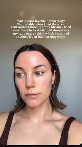 Did you know excessive amounts of B12 can actually be a trigger for  acne/rosacea? I met with an acne specialist when I had this flare up and  the first thing she ask me was what supplements/energy ...