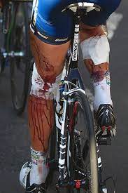 Causing him to eat it hard. 17 Cycling Icons Ideas Cycling Tour De France Pro Cycling
