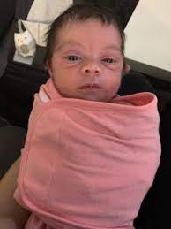 The eyes of baby raccoons open when they are about 2 weeks old. Puffy Bags Under Eyes April 2019 Birth Club Babycenter Canada