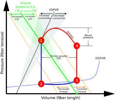 Image result for Pulse Pressure