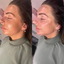 🤩 There is still availability November 16th & 17th guys and gals!  @blushandblowsalon ✨ #sunderland #aestheticssunderland #lipfiller  #jawfiller #revolaxdeep #revolaxlips #durham #durhamaesthetics  #northeastbeauty