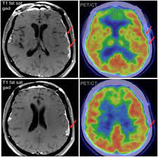 For Caribbean Patients Mri Scan Imaging Center