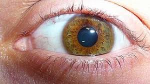 Eye Color Wikipedia