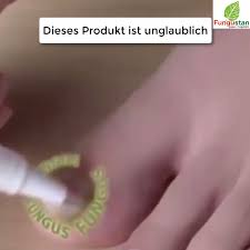 Endlich Schluss Mit Nagelpilz Video Nagelpilz Gesundheitsfakten Gesundheit