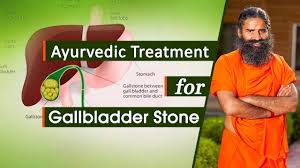 Ayurvedic Treatment For Gallbladder Stone Swami Ramdev Youtube