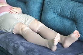 Image result for Lipodermatosclerosis