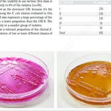 Cara mengetahui kecepatan loading blog. Pdf Colonial Morphology Of Escherichia Coli Impact Of Detection In Clinical Specimens