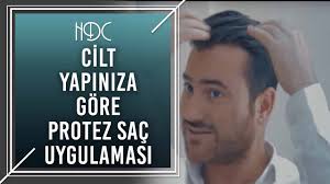 Cilt Yapiniza Gore Protez Sac Uygulamasi Hdc Youtube