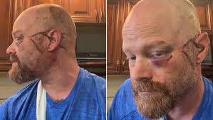 Fundraiser by Stefanie Knauss : Help my brother with medical & monthly bills