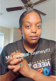 Swollen Tongue Allergic Reaction to Bed Bugs