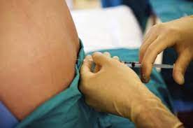 Que Efecto Te Causo La Epidural