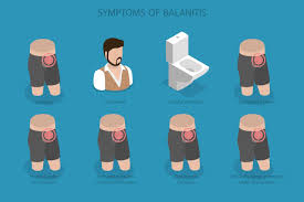 Image result for Balanitis