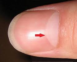 White Half Moon On Fingernails What Does It Mean Moons On Fingernails Half Moon Nails Half Moon