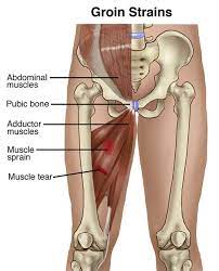 Where are the tendons in your upper legs. Physical Therapy Guide To Groin Strain Choosept Com