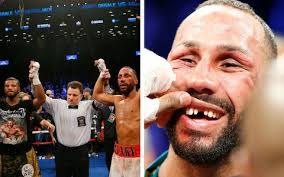 Despite the injury pouring with blood, jack was allowed to continue and. James Degale And Badou Jack Draw Unification Title Fight As Degale Gets Tooth Knocked Out