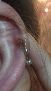 wildfleisch ist offen und nasst gesundheit und medizin piercing helix